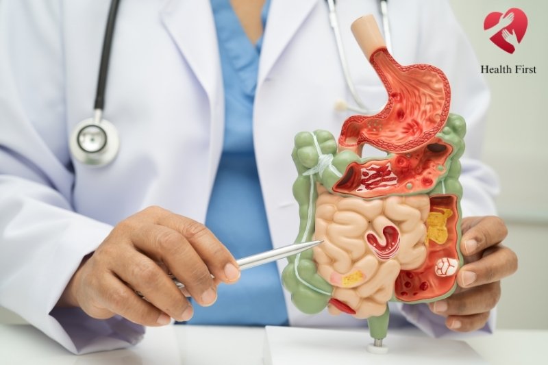 Urgent Blood in Stool Help at Cypress TX Clinic – Book Now